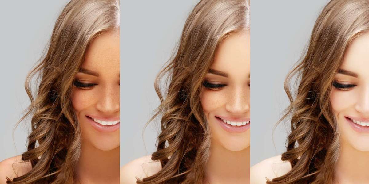 Glutathione Injection for Skin Whitening – How Long Does It Take?