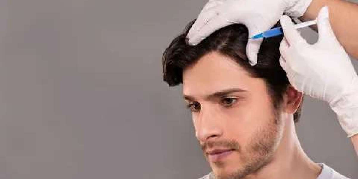 PRP Hair Treatment in Dubai: The Science of Root Restoration