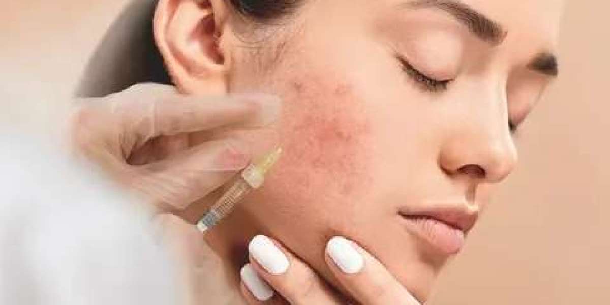 Pimples Treatment in Dubai: Custom Plans for All Skin Types